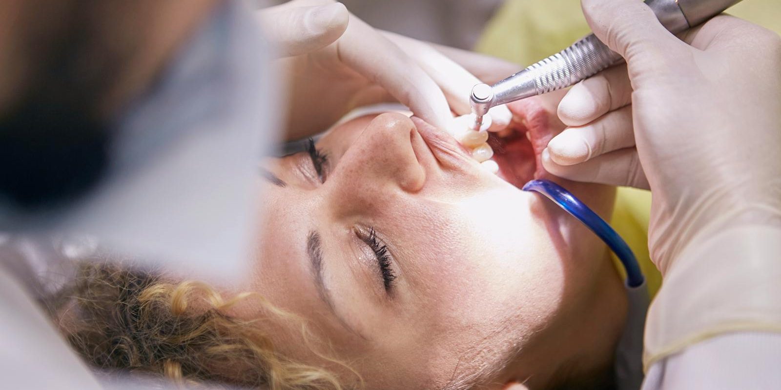 How Often Should You Visit the Dentist?